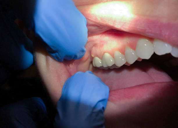 Best Emergency Treatment for Toothache in Mcswain, CA