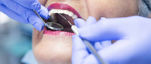 Best Emergency Treatment for Toothache in Mcswain, CA